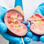 Transplantasi Ginjal Dan Hambatan Sistem Donor Di Indonesia