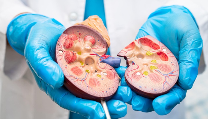 Transplantasi Ginjal Dan Hambatan Sistem Donor Di Indonesia